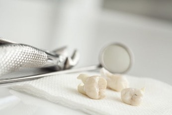 tooth_extractions